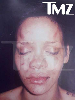 Rihanna post Chris Brown punch on